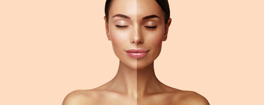 Rose Petal Powder for Skincare: Natural Solution for Acne & Tan Removal